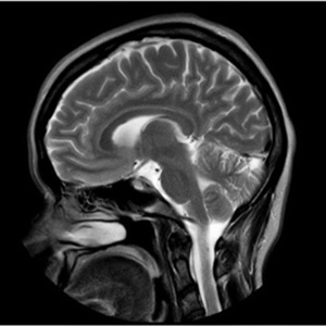 Cvmri